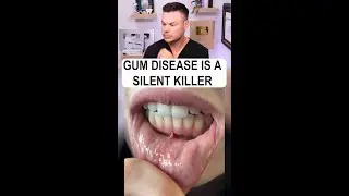 If you Have THIS, Your Gums COULD Be At Risk!