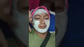 Davao Gmall Vivi Derma,kay igo tag hyperpigmentation
