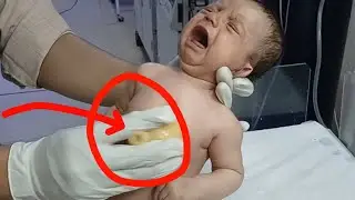 Infant Chest Congestion & Persistent Cough | Safe Physiotherapy and Massage Care#newborn #nicucare 