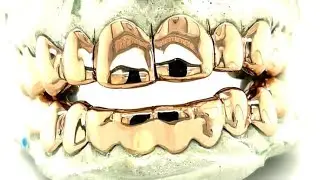 Buy perm cut grillz near tacoma wa. Buy grillz in seattle.