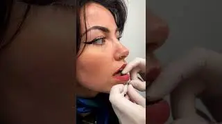 Blue Banana Labret Piercing