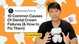Top 10 Dental Crown Failures: Causes & How to Fix Them