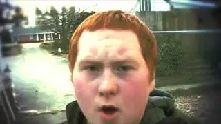 #Gingers