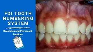 FDI Tooth Notation System | Tooth numbering system