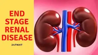 End Stage Renal Disease (ESRD) - What to do if you have end stage renal failure? | 247nht