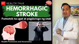 Hemorrhagic Stroke: Pumutok na ugat at pagdurugo ng utak ano ang mga sintomas at paano ito maiiwasan