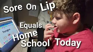 Sore On Lip Equals Home School Today
