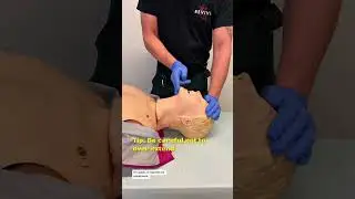 Mastering Head Tilt Chin Lift: Essential Airway Management Technique