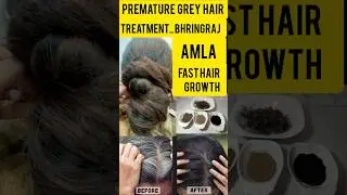 #prematuregreying #hairgrowth #blackhairdye #organicbeauty #shorts #youtubeshorts #billokadhaaba
