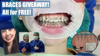 Free Braces (plus step by step procedure) | Smile of Hope Contest | Apostol Dental Philippines