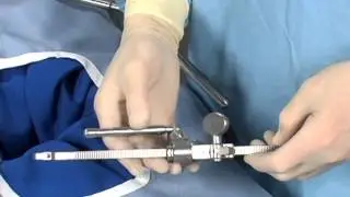 Thompson Retractor - Gynecology