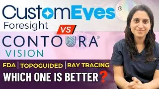 Why CustomEyes Better Than Contoura Vision I FDA, Topoguided, Ray Tracing