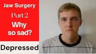 The Real Story Behind Double Jaw Surgery Experience