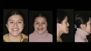 La cirugía que cambió la vida de Aradia