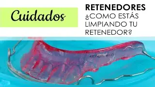 ¿COMO ESTÁS LIMPIANDO TU RETENEDOR?