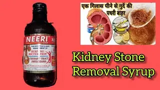 क्या नीरी सिरप किडनी के लिए अच्छा है?किडनी का आयुर्वेदिक इलाज क्या है?Kidney Stone Syrup!! #neeri