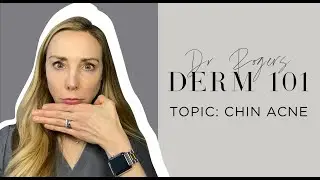 Chin Acne: Causes, Treatment, and Prevention Tips | Dermatologist's Guide