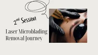2ND Laser Microblading Removal Session