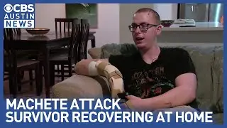 Austin machete attack survivor shares story of recovery