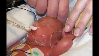 How The hi&reg; Massager Was Discovered