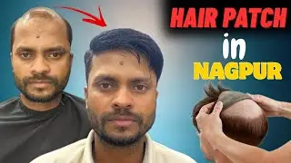 Best Hair Patch For Men in Nagpur | Hair patch in Nagpur | Best Non Surgical Hair Solution in Nagpur