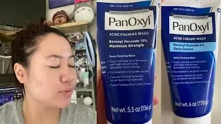PanOxyl 10 vs 4% Acne Foaming Wash | Which is better for your skin?