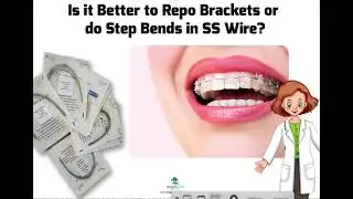 Step Bends vs Repositioning Brackets- Which is Better?