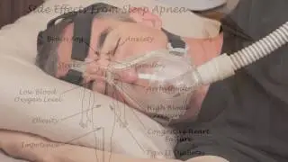Benefits of CPAP Therapy a