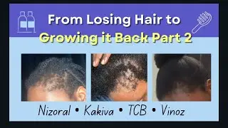 Everything I did to restore my Edges 