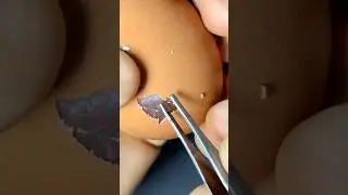 ASMR Egg Peeling Challenge 😷 #surgeonlife #medicalasmr #asmrsounds #vet #medicine #surgery #surgeon