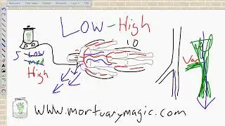 Embalming Low Pressure High Flow