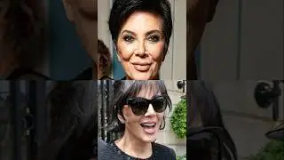 Kris Jenner's Cosmetic Secrets: Botox, Facelift, NO Nose Job?!