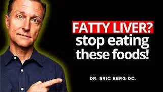 5 Food Hacks To Rapidly BURN Liver Fat | DR. ERIC BERG