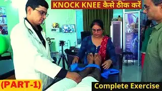 KNOCK KNEE कैसे ठीक करें Complete Exercise Part-1