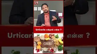 Urticaria (Hives) skin allergy treatment ~அர்டிகேரியா தோல் அழற்சி மருத்துவம் |