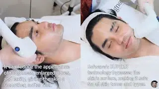 SB19 Pablo Sofwave Skin Treatment at Avignon Clinic