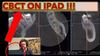 Как открыть КТ-снимки на iPad и прочитать любые рентгеновские снимки и файлы DICOM #cbct #oralrad...