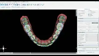 Blueskybio Direct Print Aligner Design Trial