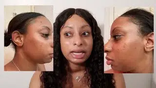 Underneath skin care Review | Did it bleach my skin??