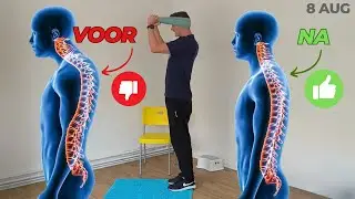 Oefeningen om een bolle rug of KYFOSE terug goed te krijgen - hyperkyfose - computerbochel.