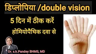double vision/diplopia की सबसे अच्छी होमियोपैथिक दवा Dr.s.k.Pandey BHMS, MD