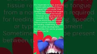 tongue tie #dental #childhealth #speech #kidshealth #oralhealth #growth #health #education #teeth