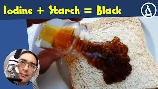 🔬 Staining tutorial: staining starch with iodine | Amateur Microscopy