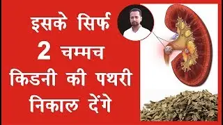 Ayurvedic Treatment For Kidney Stones | Kidney Stone Treatment