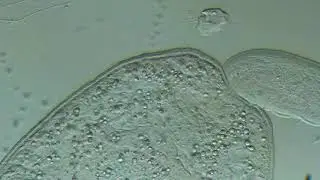 Cercaria (trematode larva)