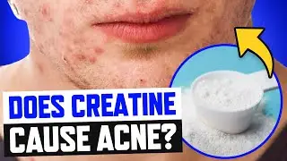 Does Creatine Cause Acne? | How to Treat and Cover Acne