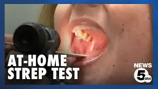 Ground-breaking research underway to test for strep throat at home