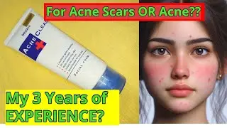 Mistine Acne Clear Face Wash Review|Honest Review