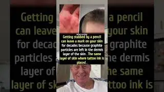 Getting Stabbed By A Pencil Can Leave A Mark on Your Skin For Decades Because of Graphite Particles.
