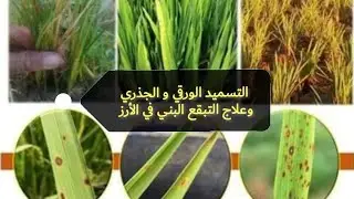 التسميد الورقي و الجذري وعلاج التبقع البني في الأرز 🌾